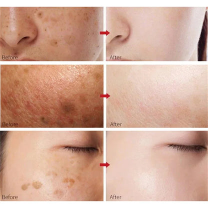NNEOBA Whitening Freckles Cream - Korean Skincare