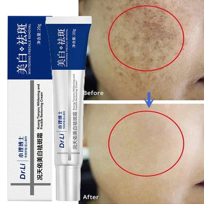 NNEOBA Whitening Freckles Cream - Korean Skincare